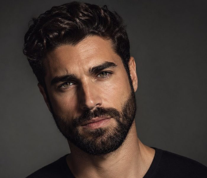 Primo piano di un uomo italiano con barba folta e capelli densi dopo trapianto combinato